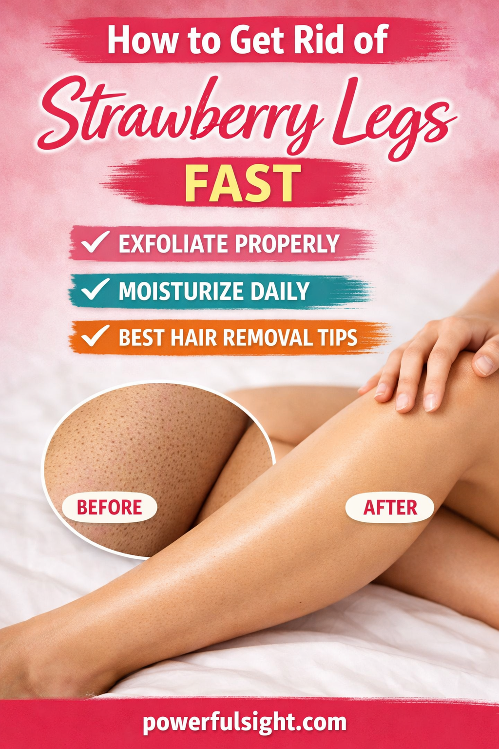 How to Get Rid of Strawberry Legs Fast